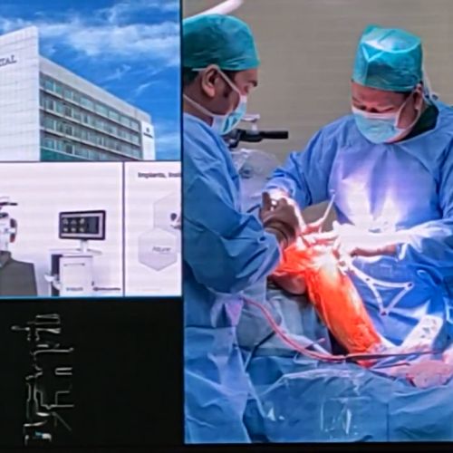 Eka Hospital Luncurkan Teknologi Robotik untuk Operasi Penggantian Lutut